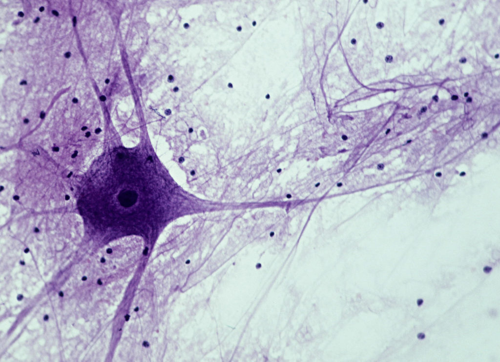 Motor neuron; Spinal Cord, 50X at 35mm. Shows: cell body, nucleus, dendrites (numerous processes attached to cell body), axon (single, long, nerve fiber), and neuroglial cells (dark spots).