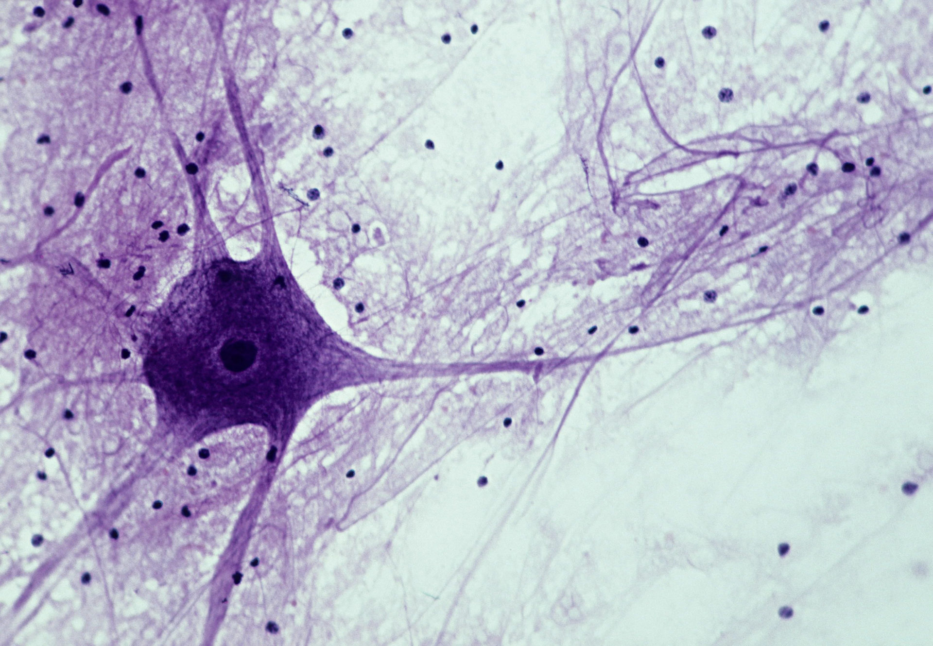 Motor neuron; Spinal Cord, 50X at 35mm. Shows: cell body, nucleus, dendrites (numerous processes attached to cell body), axon (single, long, nerve fiber), and neuroglial cells (dark spots).