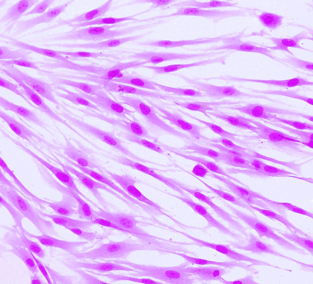Fibroblasts (skin cells) labeled with fluorescent dyes