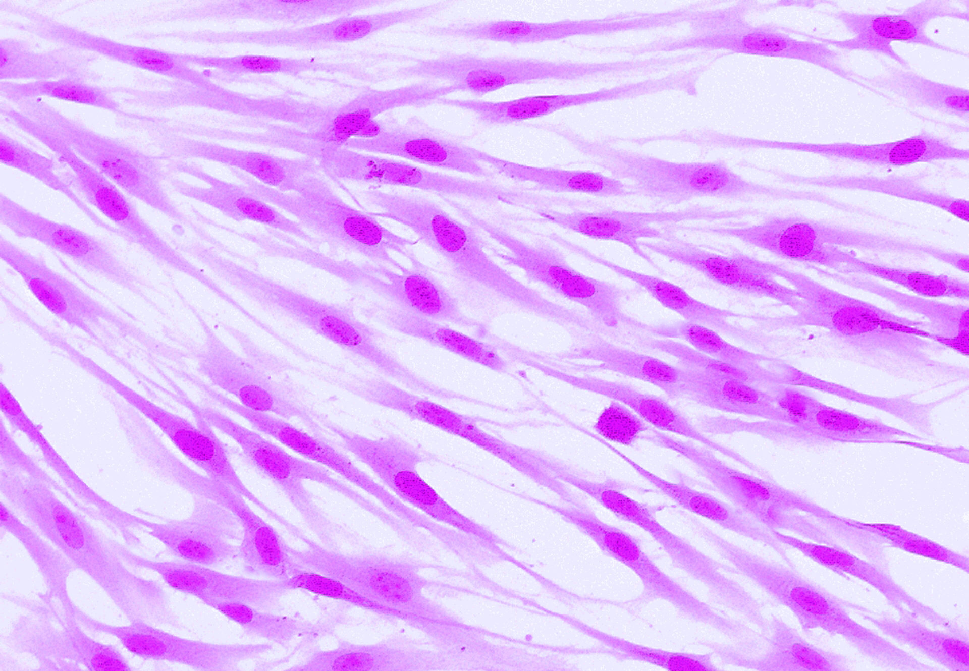 Fibroblasts (skin cells) labeled with fluorescent dyes