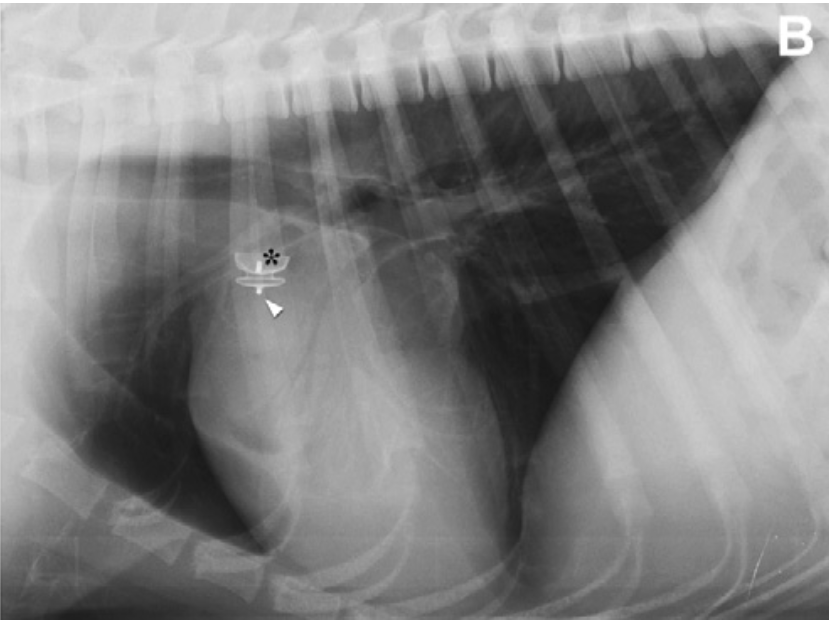 Lateral thoracic radiograph demonstrates correct placement of the ACDO.